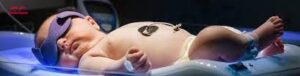 عوارض زردی نوزاد در بزرگسالی