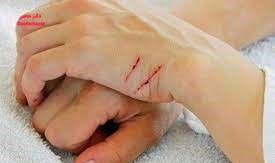 زخم های حاد و مزمن