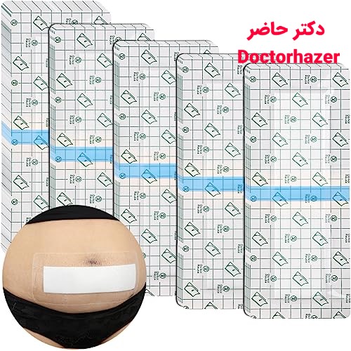 آشنایی با عمل ابدومینوپلاستی