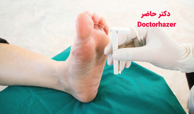شستشوی زخم دیابتی