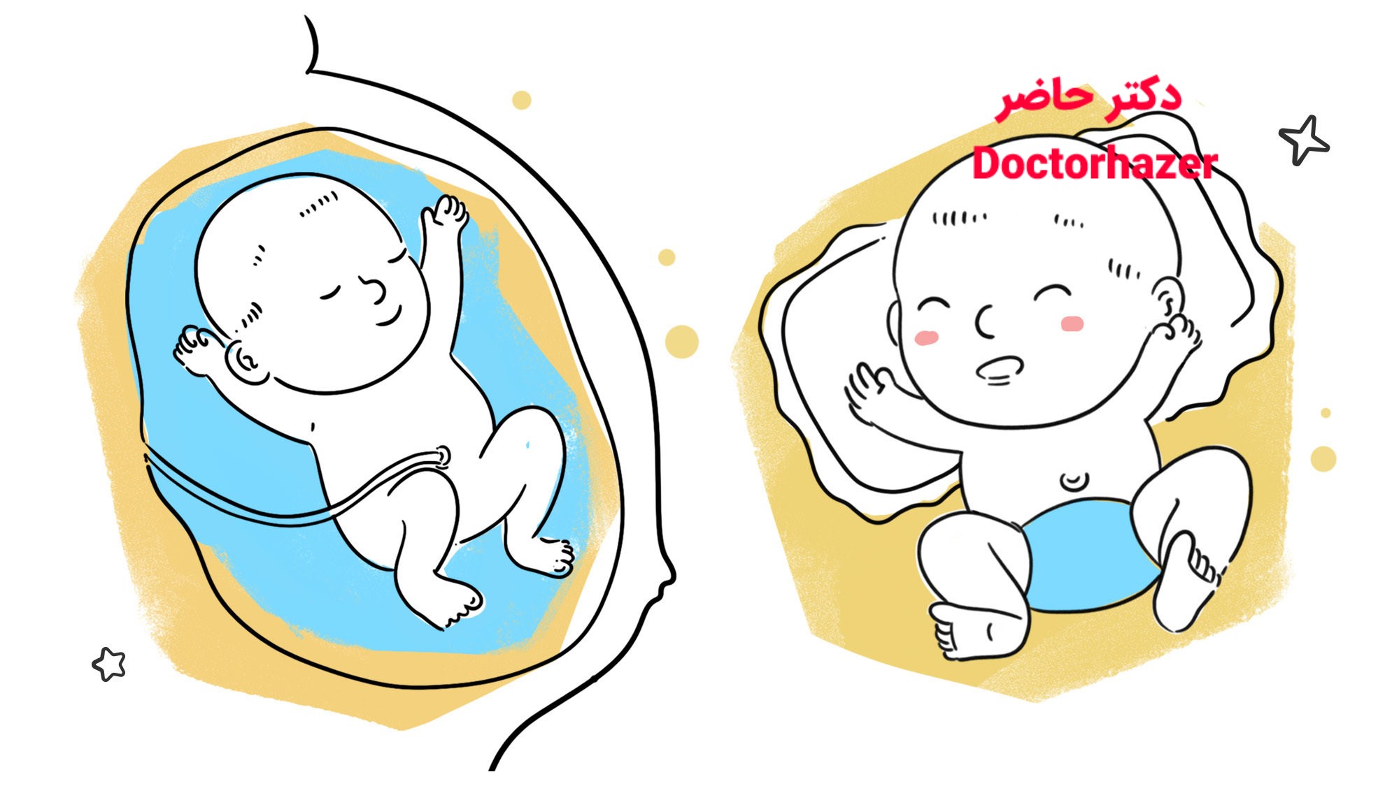 التیام بند ناف