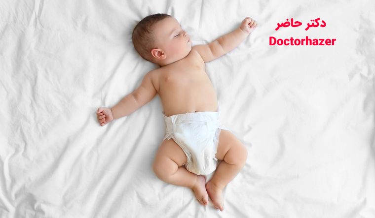 ترشح ناف نوزاد