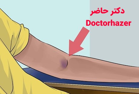 تکنیک‌های صحیح خونگیری