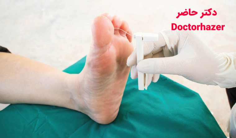 درمان زخم پای دیابتی