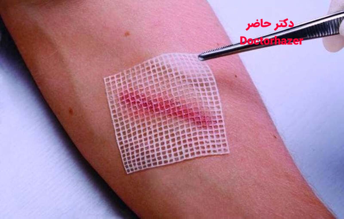 ضدعفونی زخم