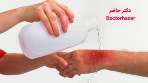 ضدعفونی زخم