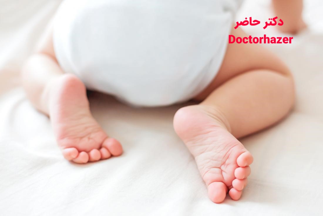 عفونت پوست نوزاد