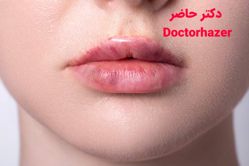 عوارض تزریق سرم