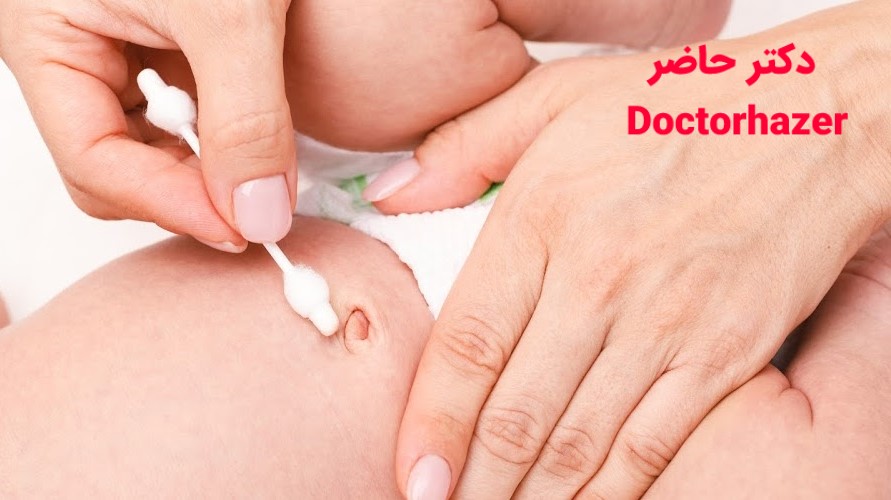 نظافت بند ناف