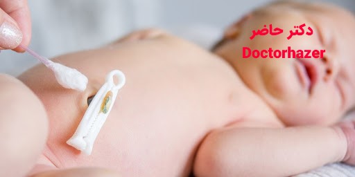 پاک کردن بند ناف