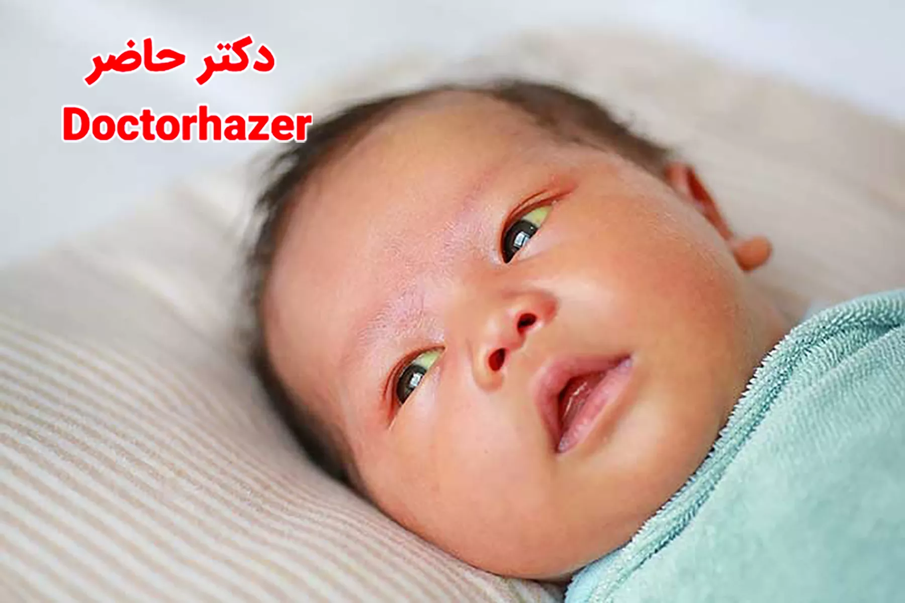 نقش فتوتراپی در بهبود زردی