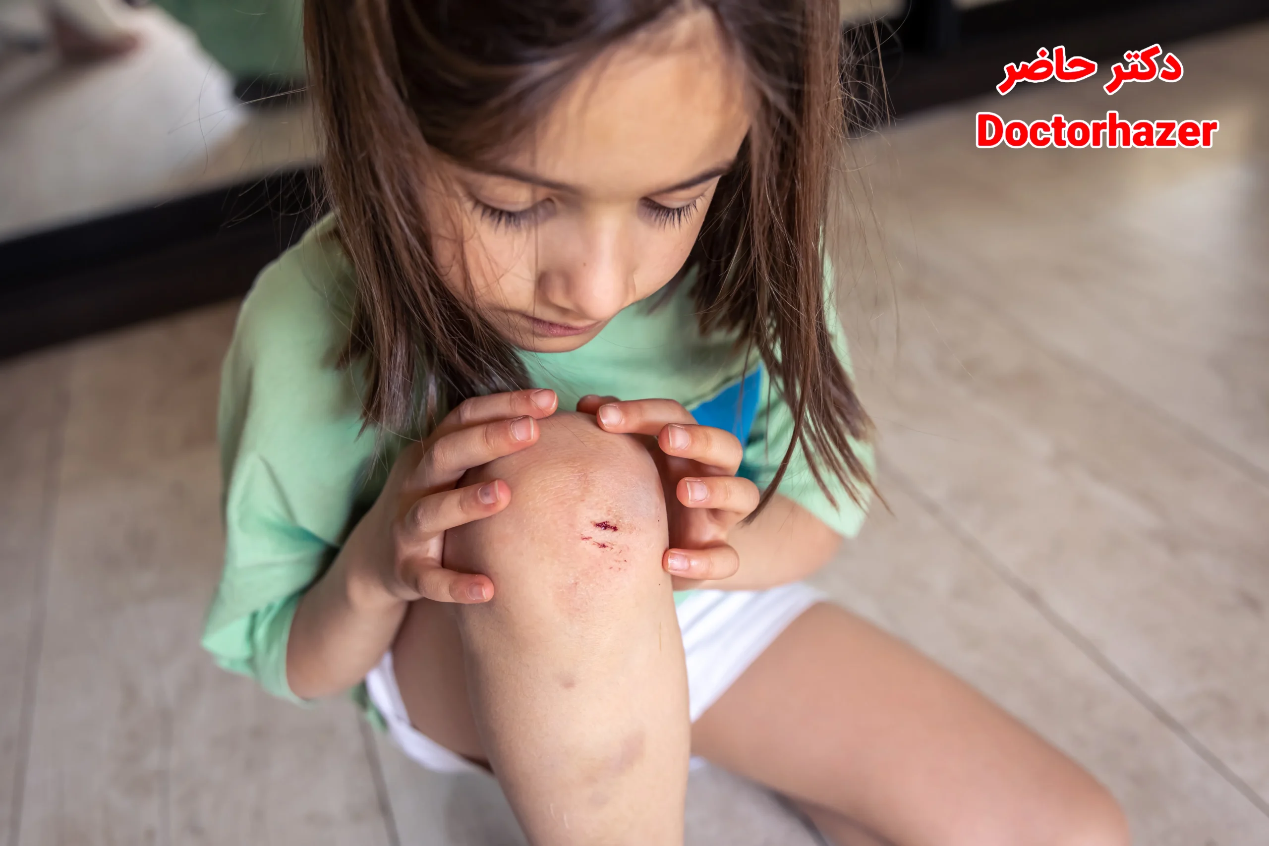 انتخاب پانسمان مناسب برای زخم کودکان