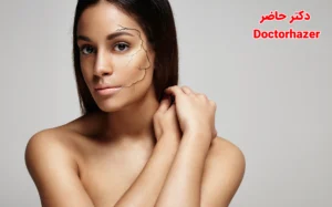 چرا جای زخم روی پوست باقی می ماند؟ راه های پیشگیری و درمان