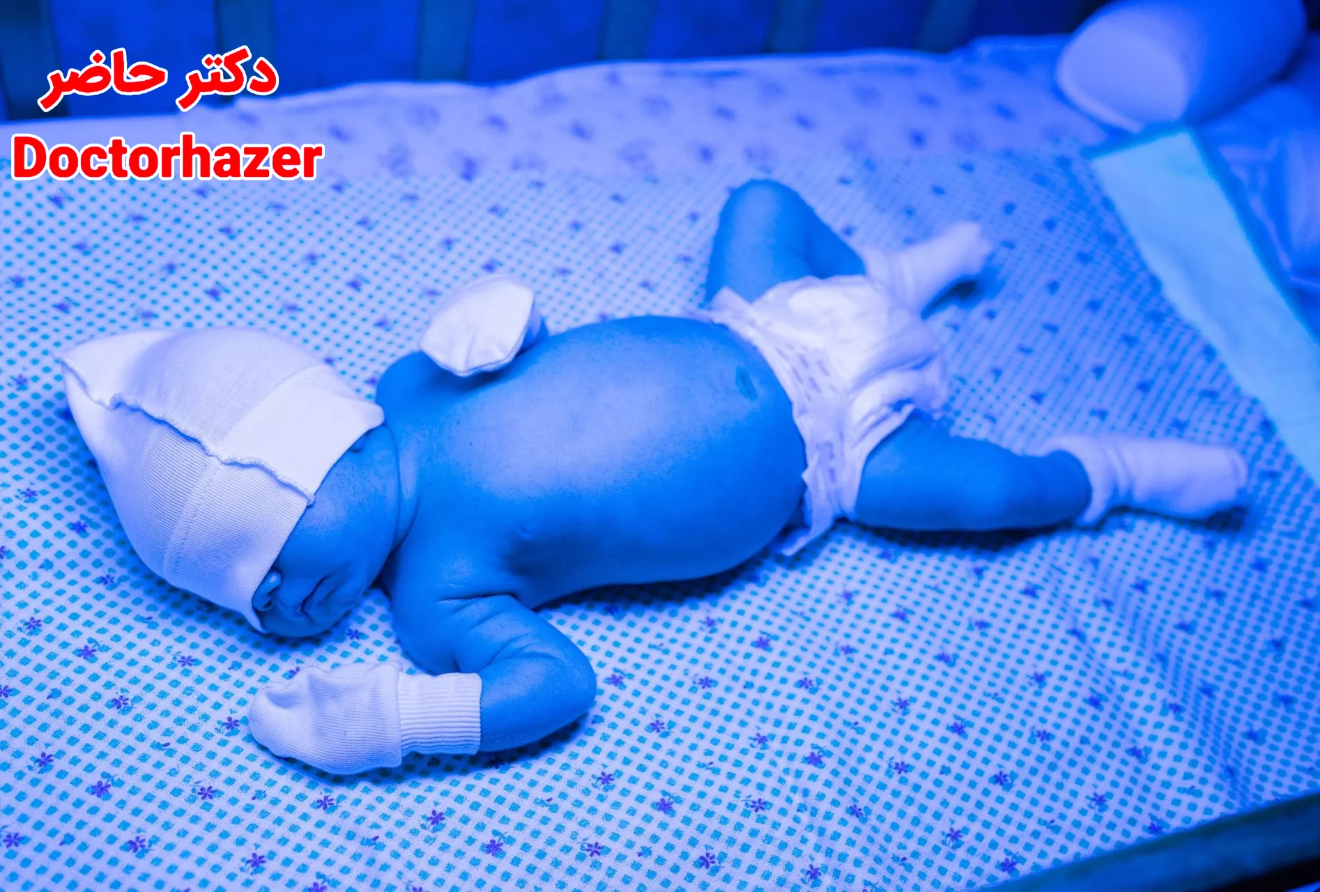 علل بروز زردی هنگام شیردهی