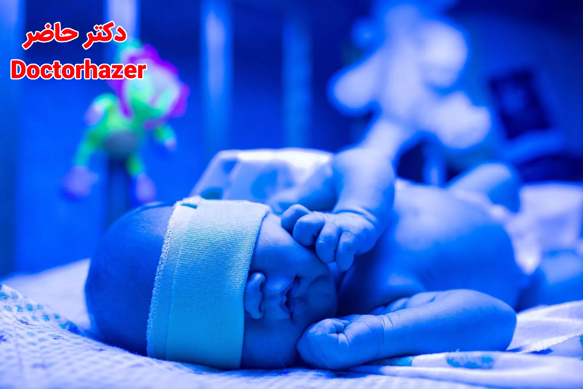 تفاوت زردی ناشی از شیر مادر با سایر انواع