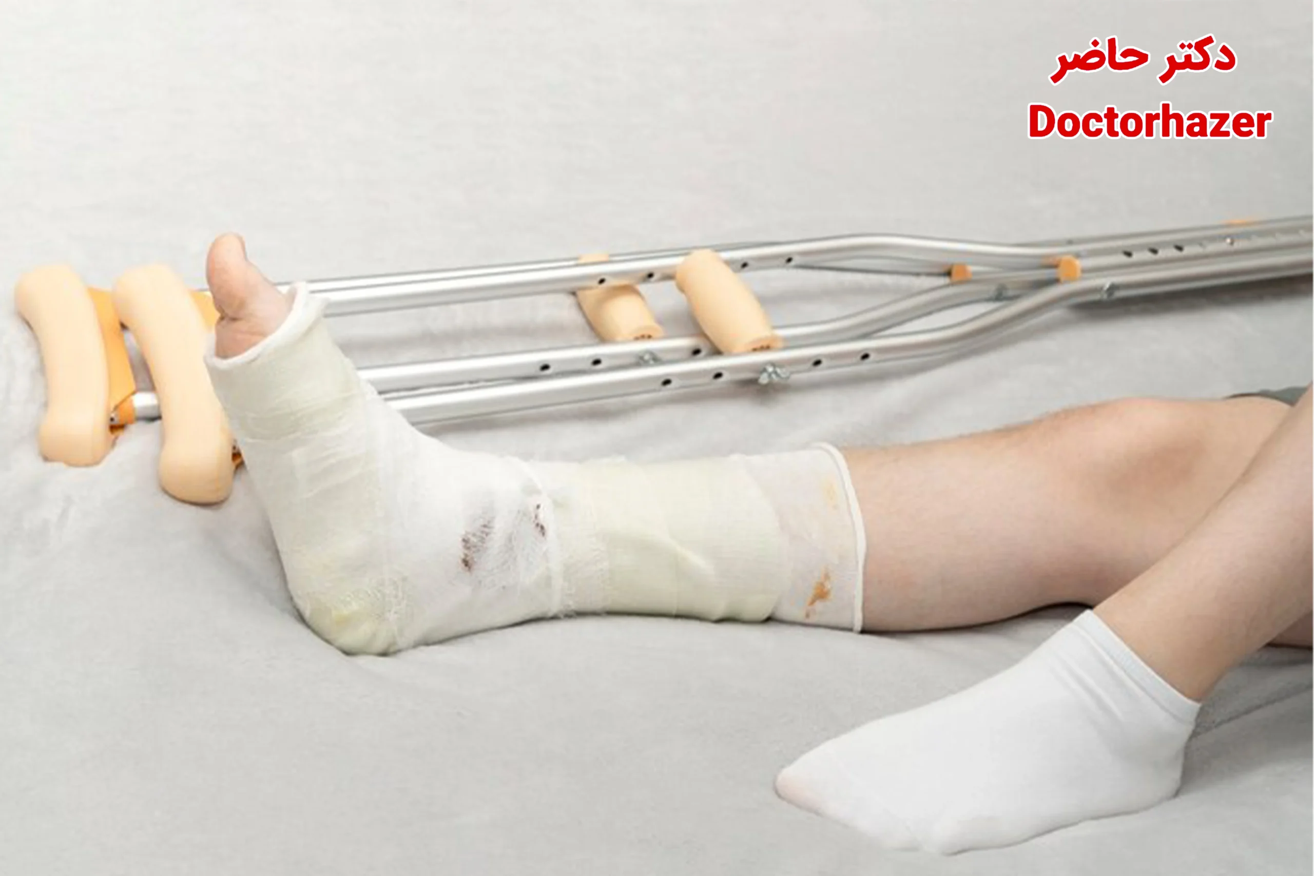 ابزار مورد نیاز برای باز کردن گچ پا در منزل