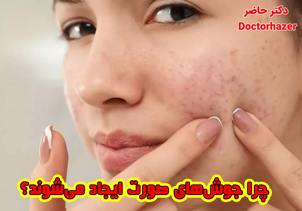 اشتباهات رایج در درمان خانگی جوش صورت