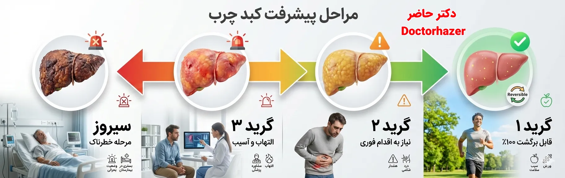 مراحل و گریدهای کبد چرب
